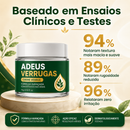 Adeus Verrugas Creme [COMPRE 1 LEVE 2] + Frete Grátis